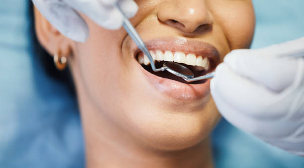 Best Emergency Treatment for Toothache in Fairfield, TX